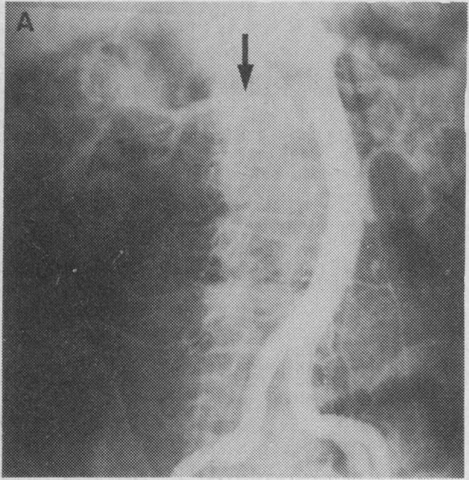 FIG. 1A