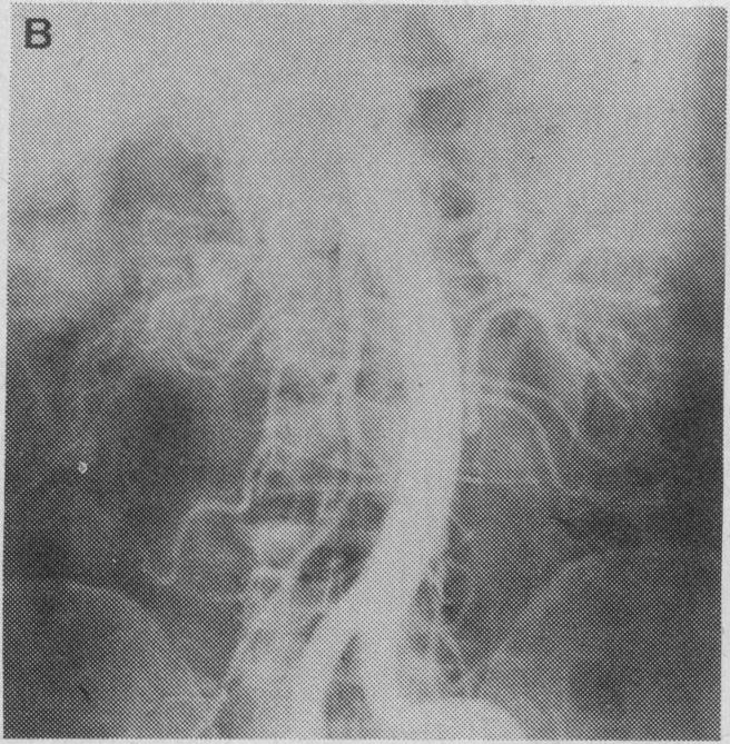 FIG. 1B