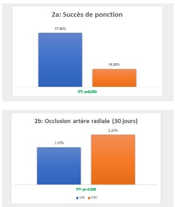 
Figure 2. Critères de jugement principaux selon les deux groupes de
l’étude
Hôpital militaire principal d’instruction de Tunis entre février 2022
et Mai 2022
2a : Taux de succès de la ponction selon les groupes 2b : Echographie
Doppler à 30 jours selon les groupes
ITT en intention de traiter ; VRC voie radiale conventionnelle ; VRD
voie radiale distale