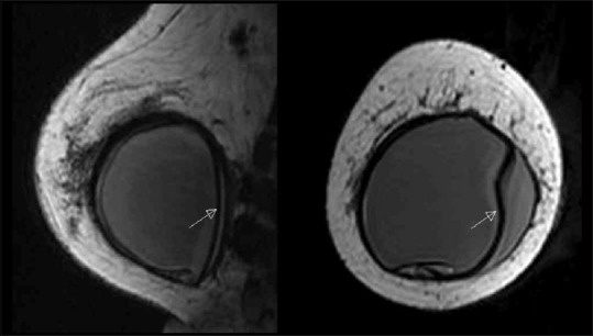 Figure 23