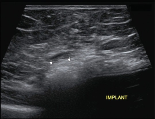 Figure 25