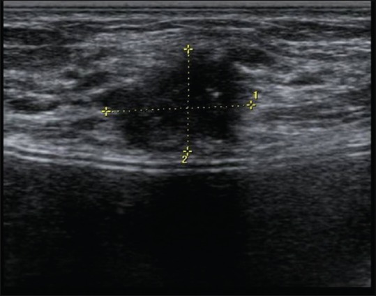 Figure 27