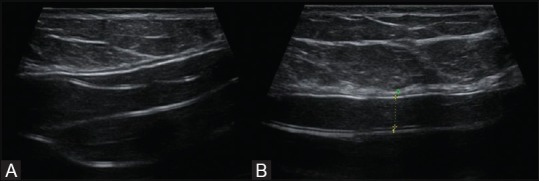 Figure 20 (A and B)