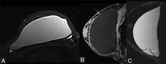 Figure 10 (A-C)