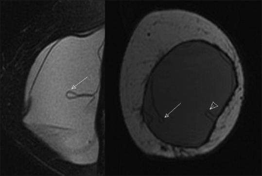 Figure 22