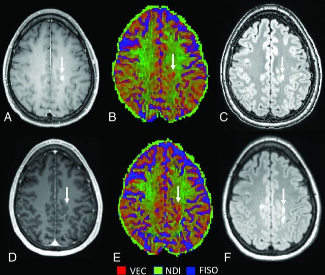 FIG 3.