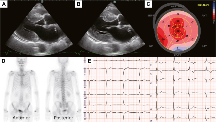 Figure 1