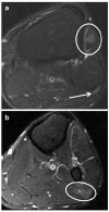 Fig. 16