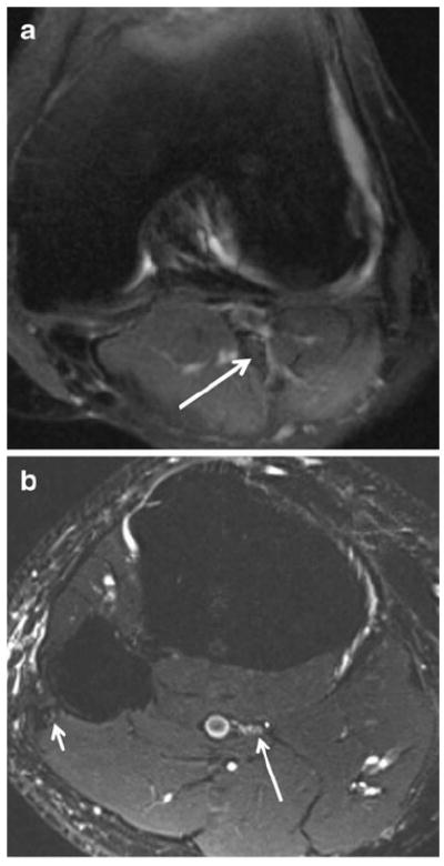 Fig. 15