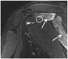 Fig. 11