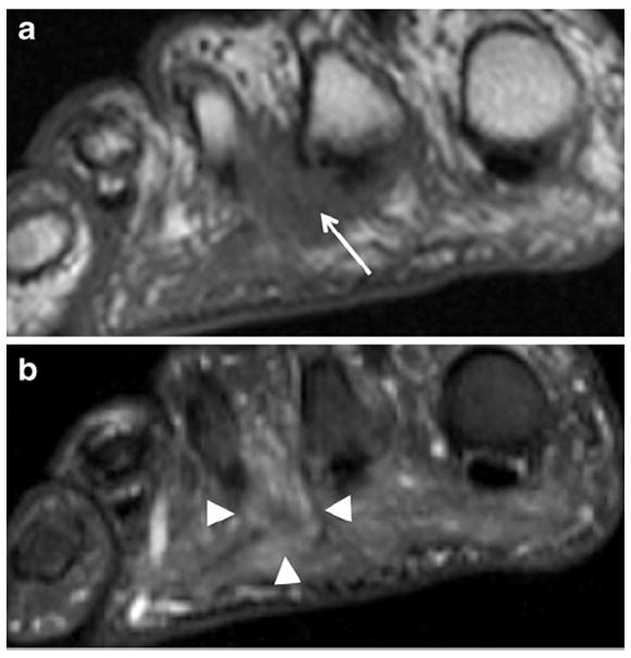 Fig. 18