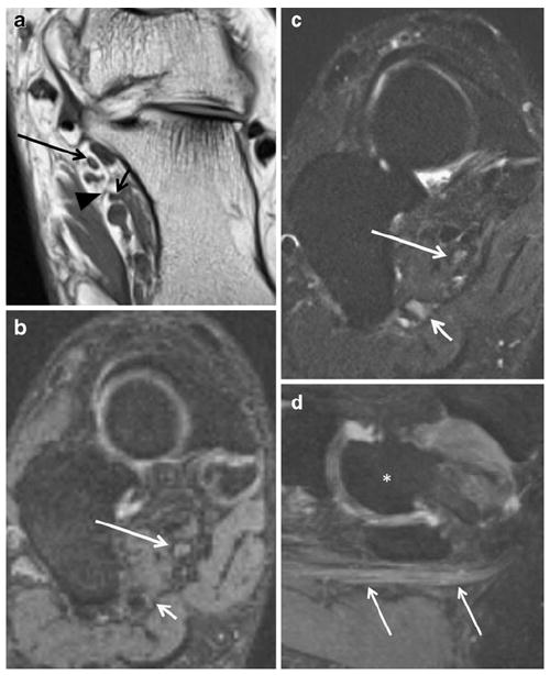 Fig. 17