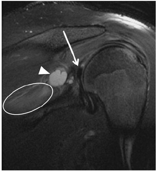 Fig. 12