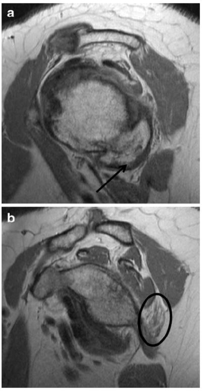 Fig. 13