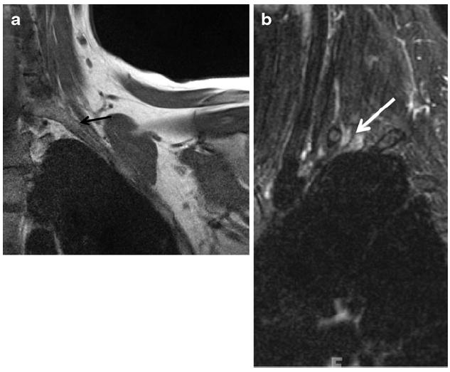 Fig. 14