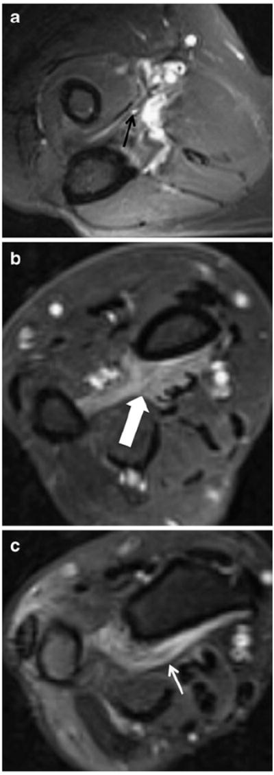 Fig. 10