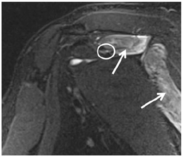 Fig. 11