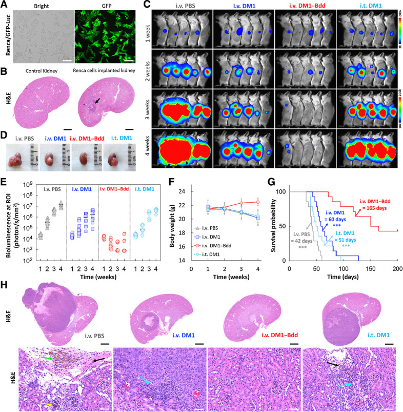 Figure 5. Therapeutic efficacy of DM1–Bdd in treating renal carcinoma. A, Brightfield and fluorescence images of Renca cells that were stably transduced with a lentivirus carrying both GFP and firefly luciferase genes. Scale bar, 80 μm. B, Syngeneic xenograft model. Representative image of the histologic analysis of kidneys collected from female BALB/cJ mice (n = 3) 1 week after implantation of murine Renca cells (4 × 103 cells/animal) in the renal capsules (black arrow). Scale bar, 1 mm. C, Representative merged bioluminescence/brightfield images of BALB/cJ mice bearing Renca/GFP-Luc tumors after treatment with intravenous PBS (150 μL), intravenous DM1 (0.75 mg/kg, 150 μL), intravenous DM1–Bdd (0.75 mg/kg of drug content, 150 μL), or intravesical DM1 (0.75 mg/kg, 50 μL) weekly for 3 weeks (n = 10/group). D, Representative photos of the kidneys excised from the animals after completion of the treatment cycle (additional n = 4/group). E–G, Longitudinal comparisons of bioluminescence signals at the region of interest (ROI = kidney; E), body weight (F), and survival (G) among animals receiving different treatments (n = 14/group). The significant differences in survival between animals treated with intravenous DM1–Bdd and the drugs was evaluated using the Mantel–Cox log-rank test and the Benjamini and Hochberg adjusted P values. ***, P < 0.001. H, Representative kidney sections from animals of each treatment group (additional n = 4/group). The sections were stained with H&E. The green, yellow, black, and blue arrows indicate the presence of pigment-laden macrophage, focal mineralization, interstitial fibrosis, and mononuclear cell infiltrates, respectively. Scale bars, 2 mm and 50 μm.