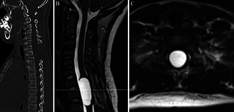 FIG. 1.