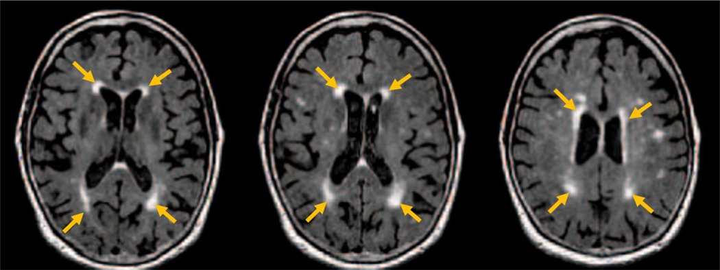 Figure 5-