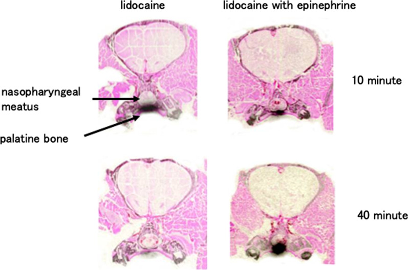 Fig. 2