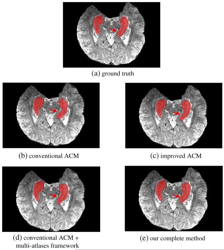 Fig. 7