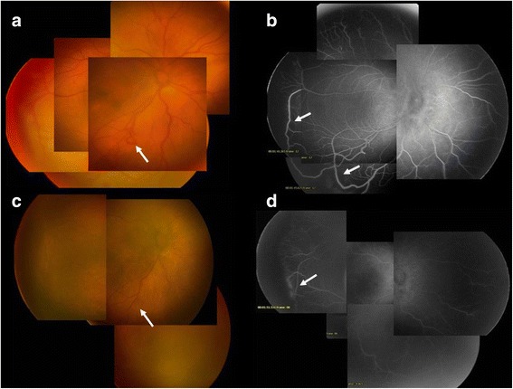 Fig. 1