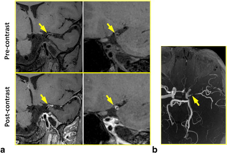 FIG. 6