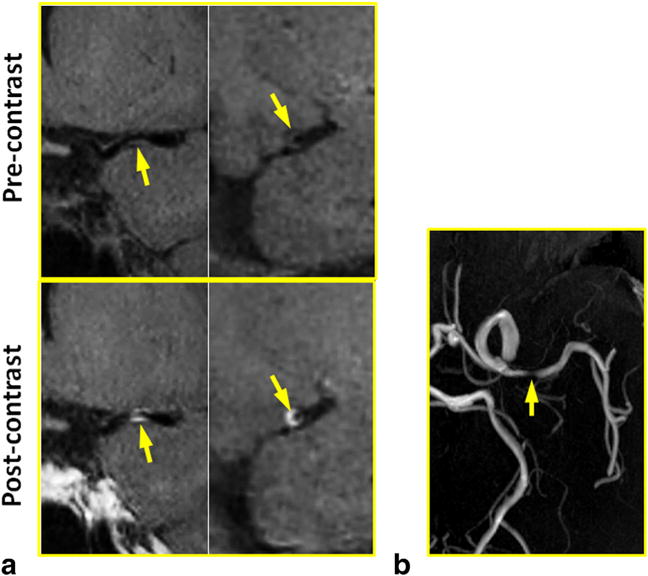 FIG. 5