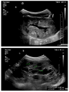 Figure 18