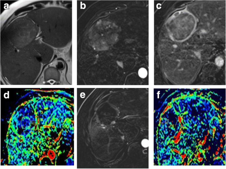 Fig. 14