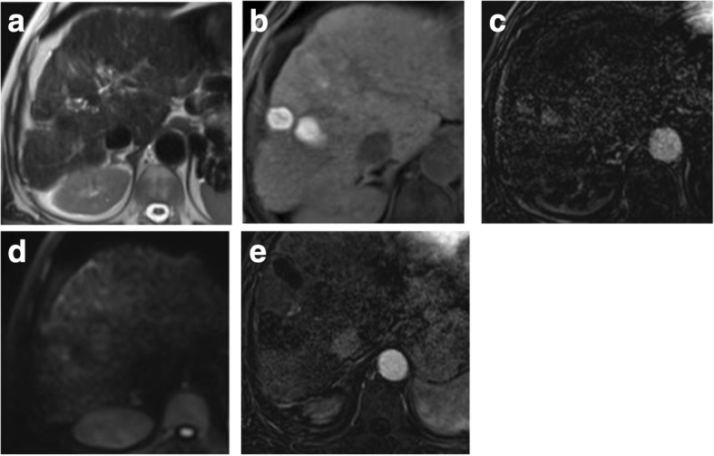 Fig. 12