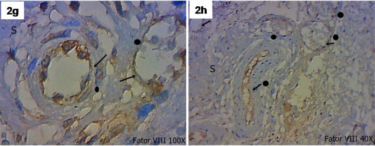 Fig. 2 - G,H