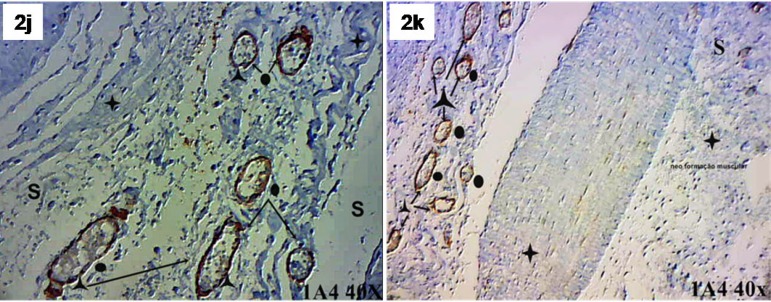 Fig. 2 - J,K