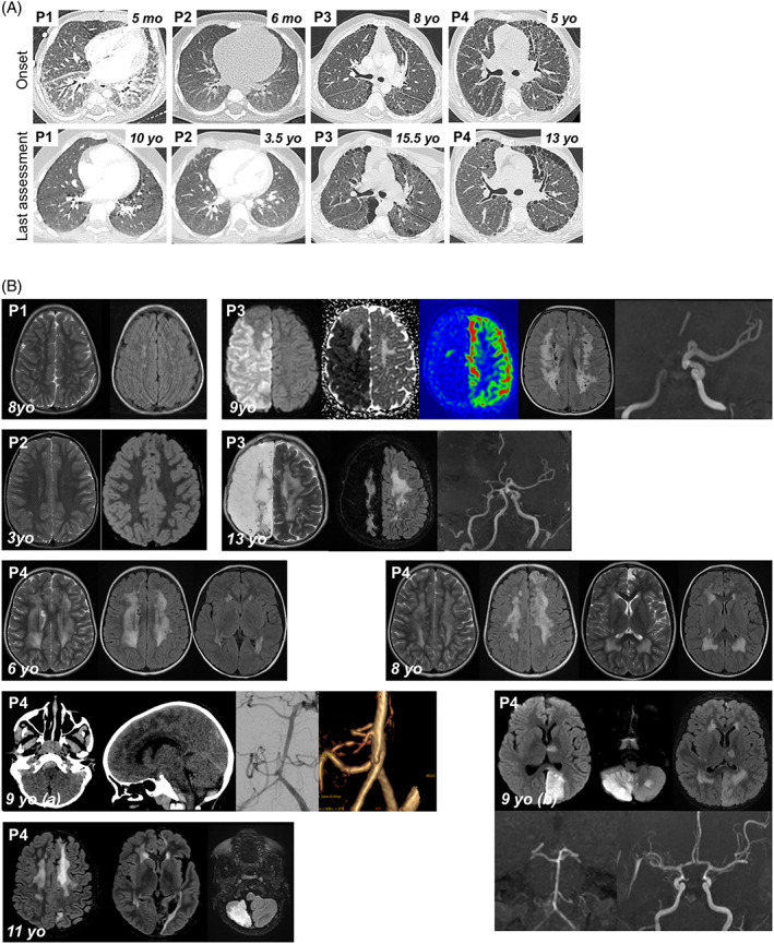 FIGURE 1