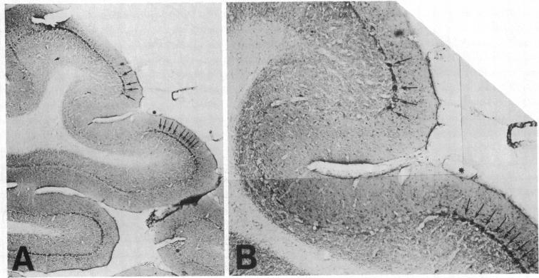 graphic file with name pnas00360-0420-a.jpg