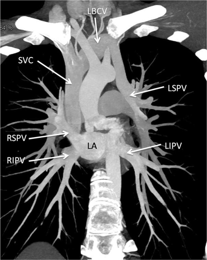 Figure 10. 