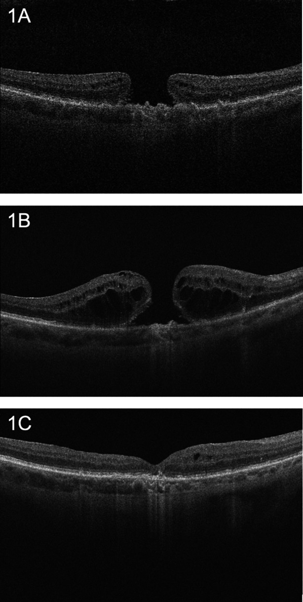 Fig. 1
