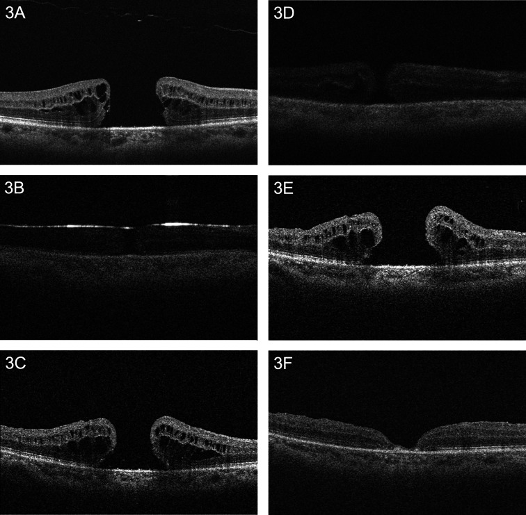 Fig. 3