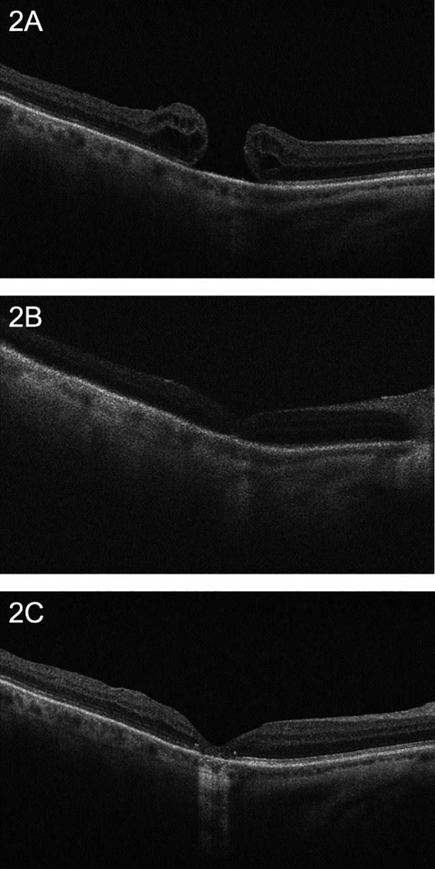 Fig. 2