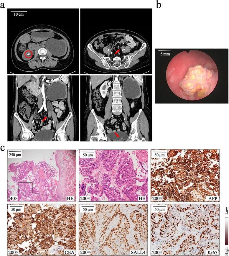 Fig. 1