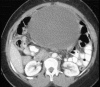 Fig. 2