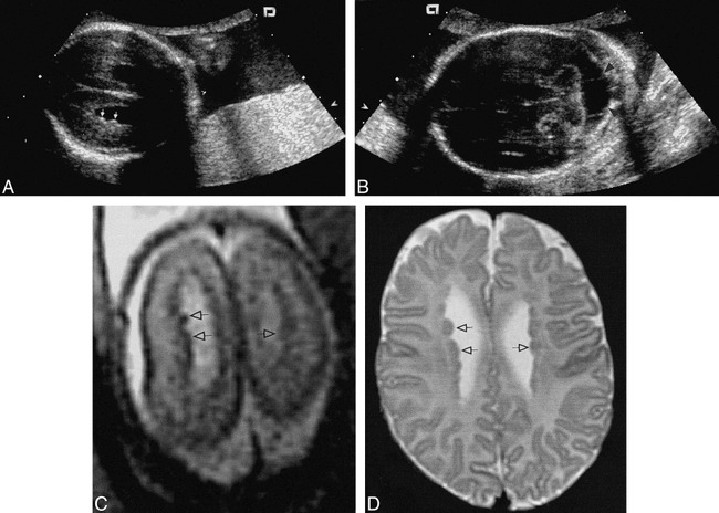 FIG 1.