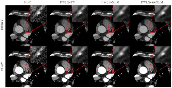 Figure 10