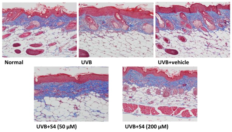 Figure 14