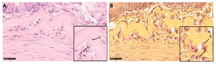 Figure 13