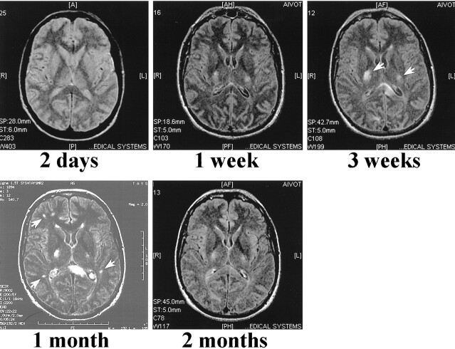 fig 2.