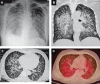Fig. 10