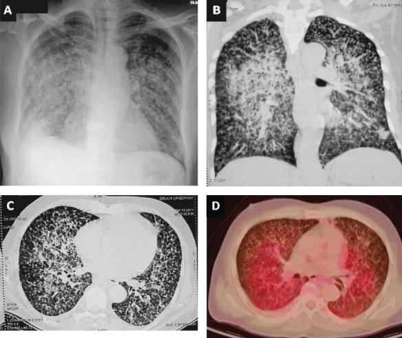 Fig. 10