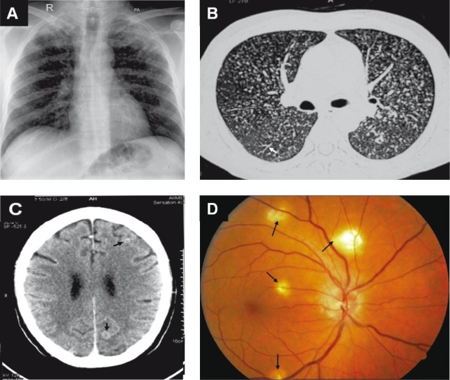 Fig. 4